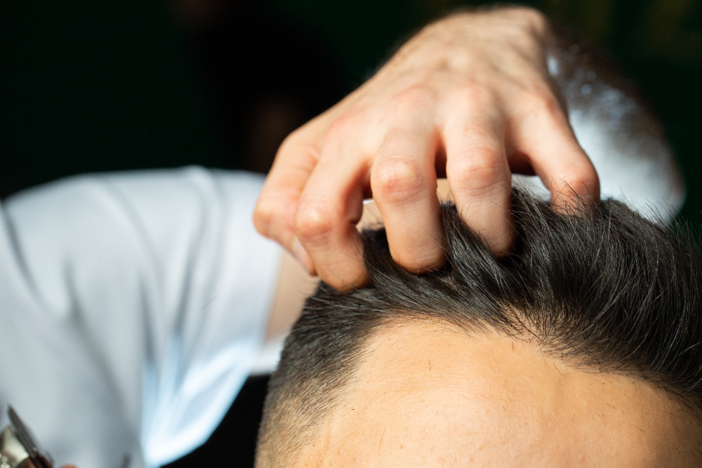 Effective Thinning Hair Treatment: What Works and What Doesn’t